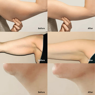 Zumia™ - Organic Lymphatic Support